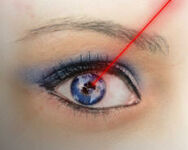 Laser eye surgery.